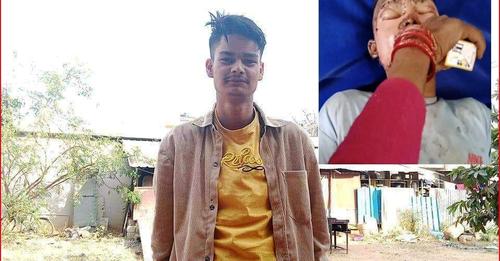 वनको डढेलो निभाउने क्रममा घाईते बिष्टको उपचारका लागि आर्थिक अभाव