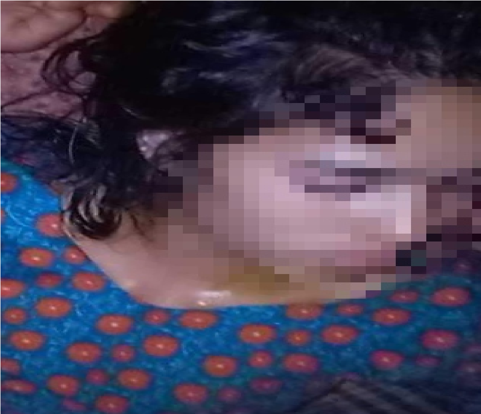 सिगास : भुवनेश्वरी माविका प्रधानाध्यापक द्वारा छात्रालाई निर्घात कुटपिट,अखिल नेपाल विद्यार्थी युनियनको ध्यानकार्षण
